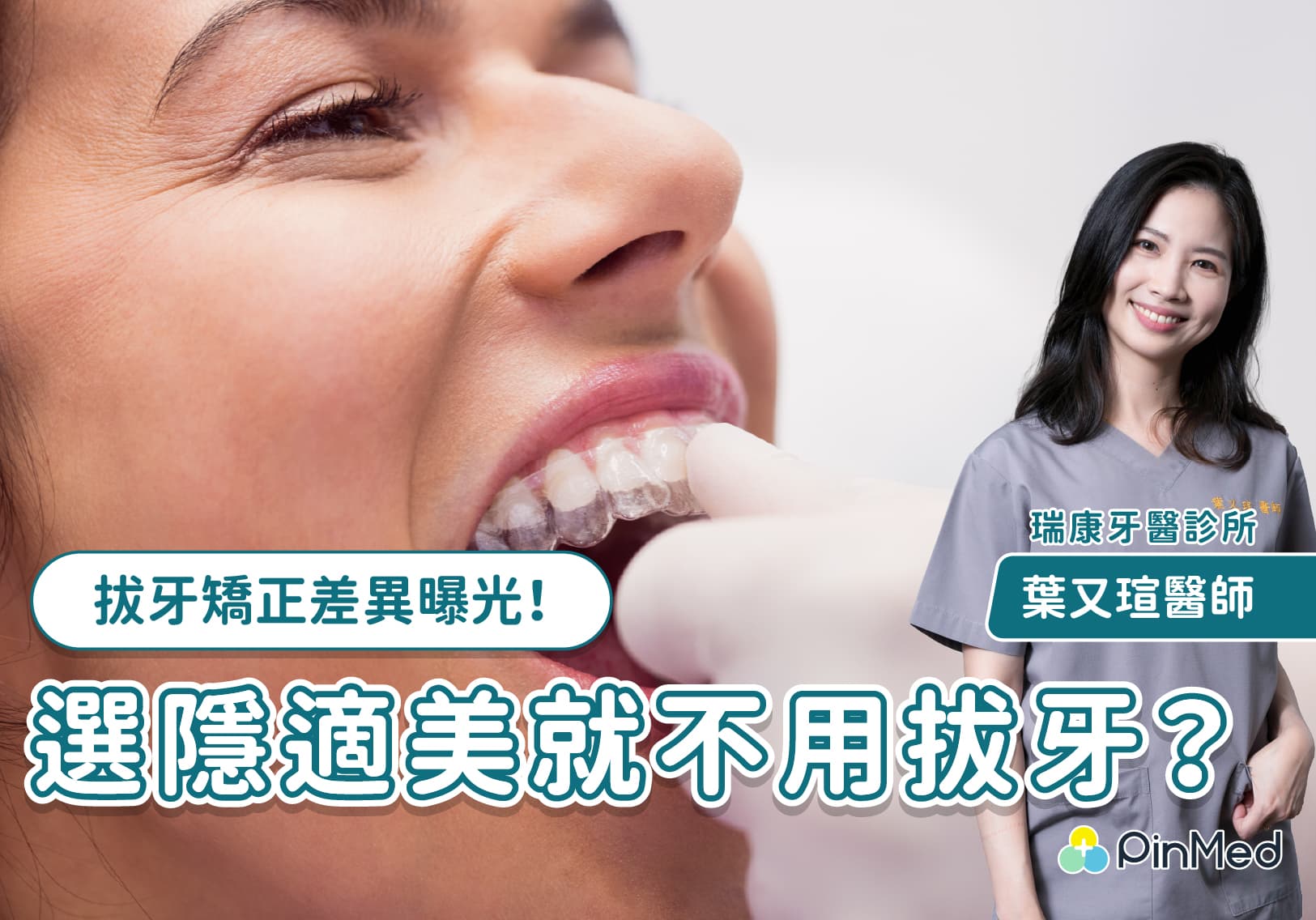 隱適美拔牙