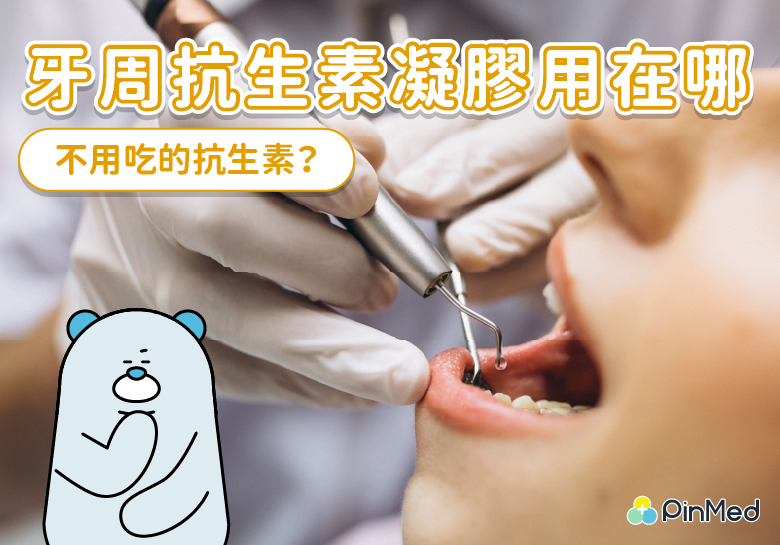 牙周病會自己好嗎？治療靠牙膏、漱口水是否可行　抗生素凝膠又是什麼
