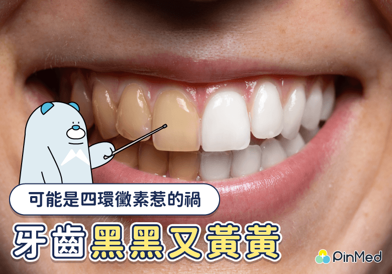 四環黴素讓牙齒變黃 如何美白看這邊!三種方式優缺點全面剖析 - PinMed
